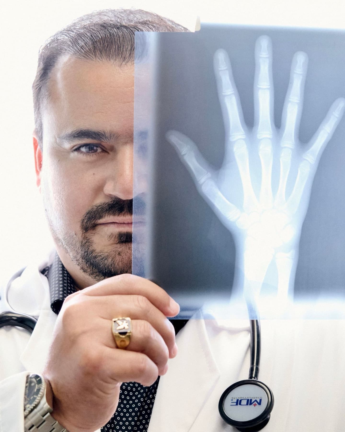 Dr. Hendry Pascual in a white coat holding up an X-ray of a hand